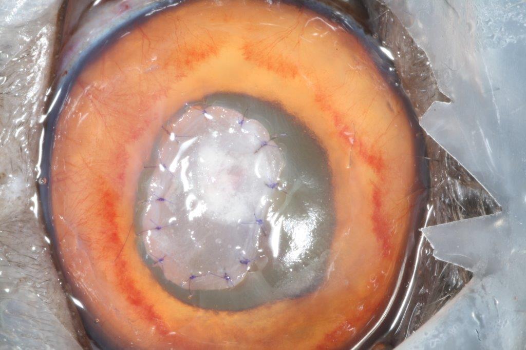 biometria-ulcera-corneal